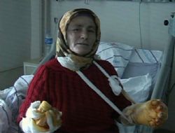Aşure yaparken tandıra düştü